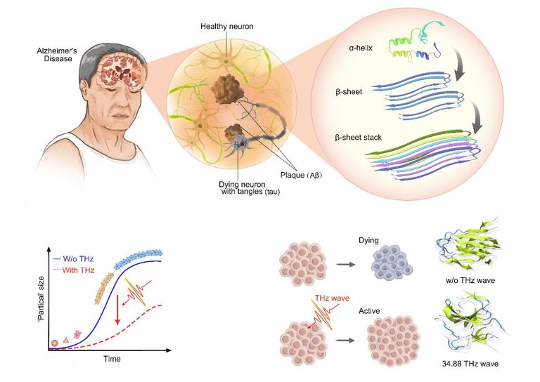 Radiao terahertz mostra potencial para tratamento no invasivo contra Alzheimer