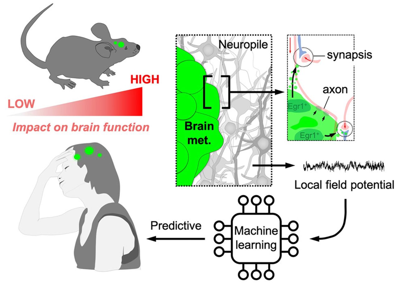 Tumores cerebrais hackeiam a comunicao entre os neurnios