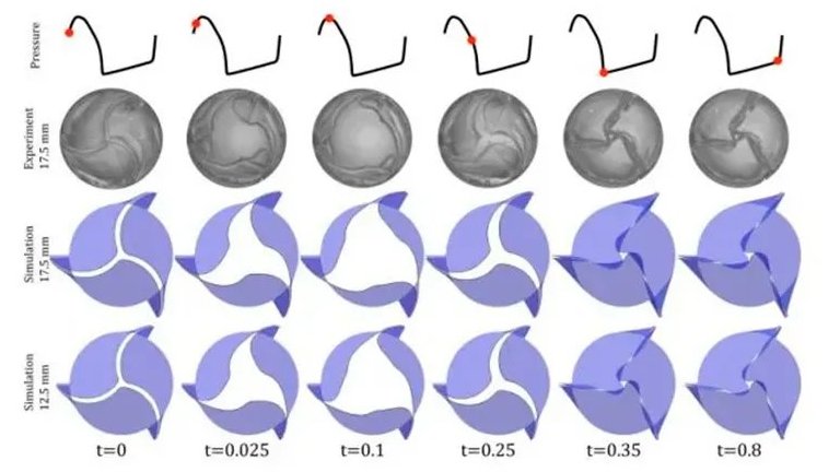 Cientistas brasileiros melhoram projeto de válvula cardíaca inovadora