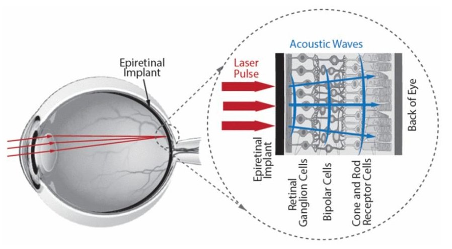 Nanomaterial para implante de retina restaura viso usando sons
