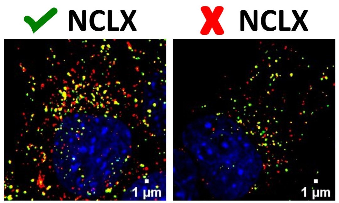 Cientistas descobrem como o metabolismo energtico  regulado em nvel celular