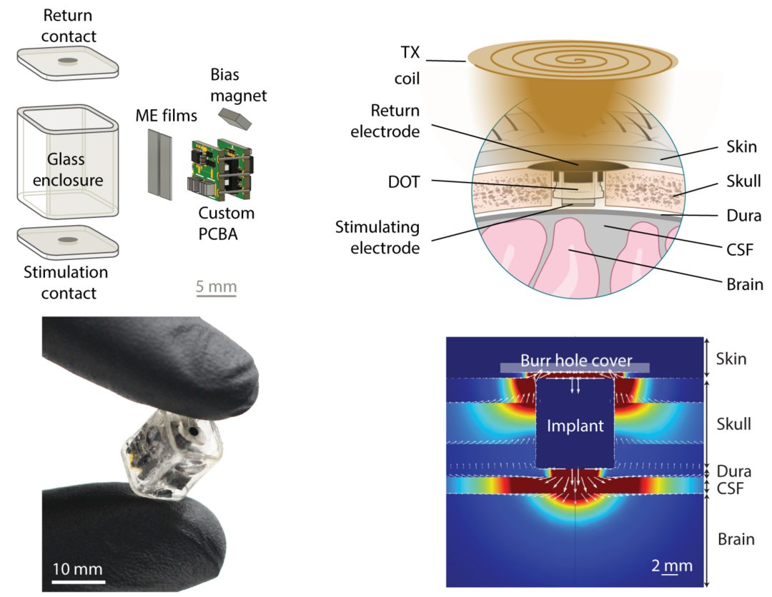 Estimulador cerebral miniaturizado e sem fios é testado em humanos