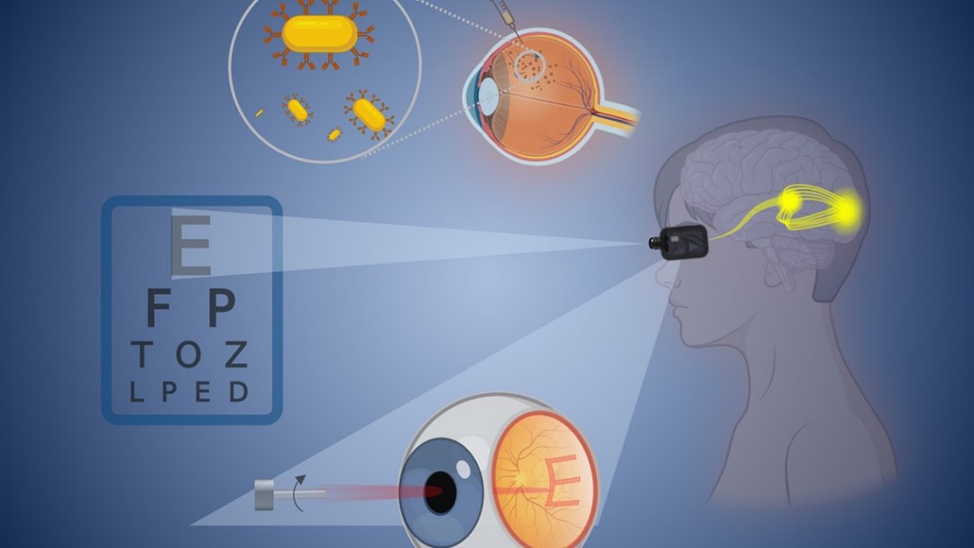 Olhos de ouro: Nanopartculas podero restaurar a viso