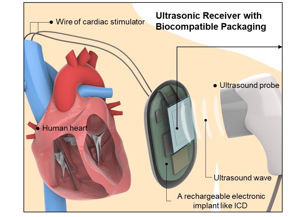 Recarregamento de bateria sem fio ultrassnico para implantes mdicos