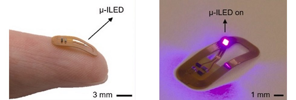Medicamento ativado por luz s faz efeito no local preciso onde  necessrio