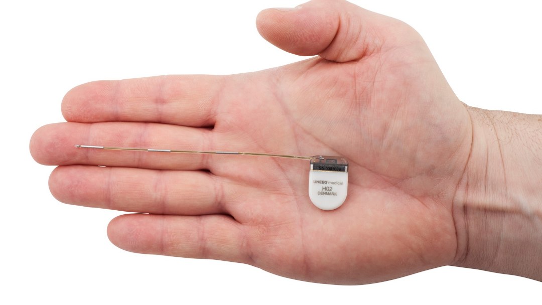 Aparelho do tamanho de uma moeda monitora epilepsia continuamente