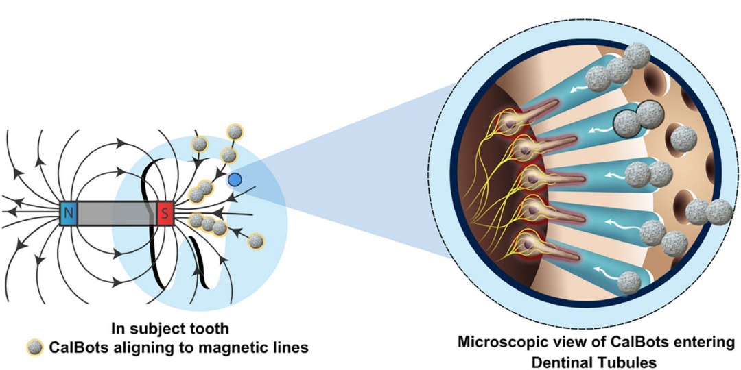 Nanorrobs guiados magneticamente curam sensibilidade dentria