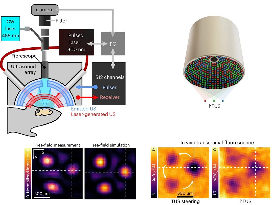 Hologramas de ultrassom vo tratar Alzheimer, Parkinson e muito mais