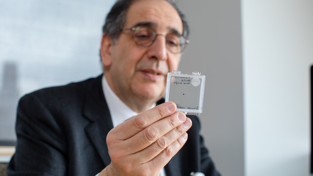 Implante de retina restaura visão em pacientes com degeneração macular