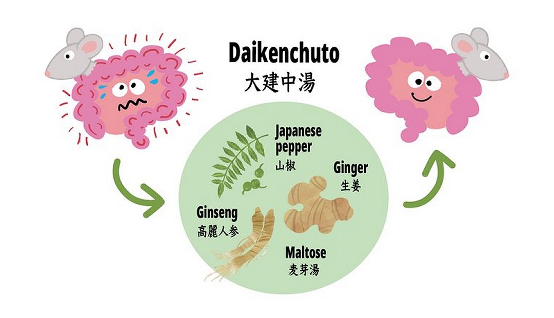 Esqueça as fibras: Contra intestino preso, vá de kiwi