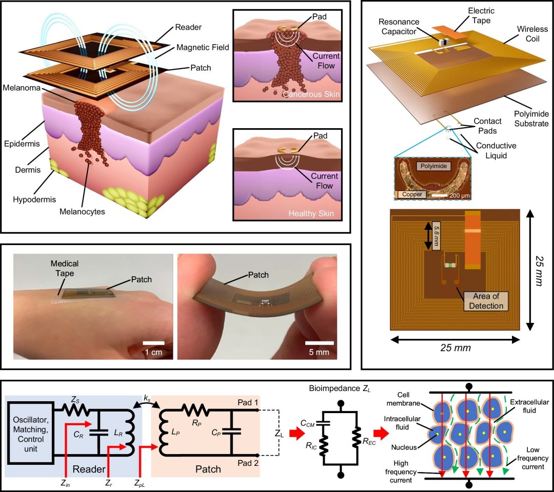 Adesivo detecta precocemente suspeitas de câncer de pele