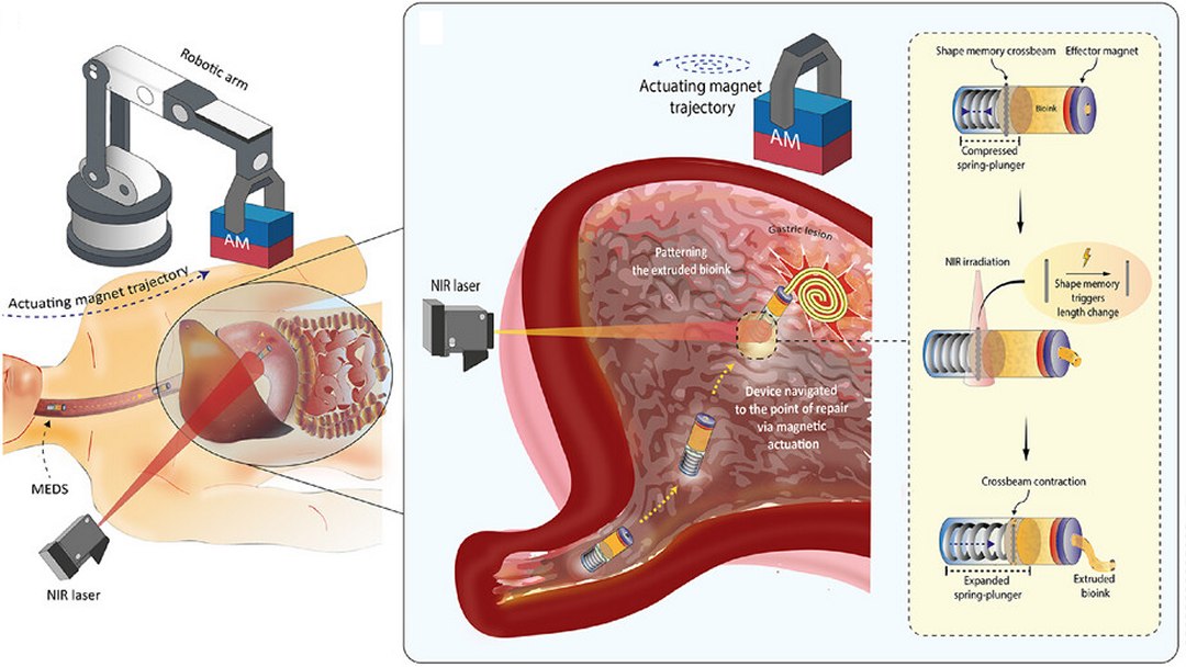 Impressora de engolir usa biotinta para reparar feridas internas