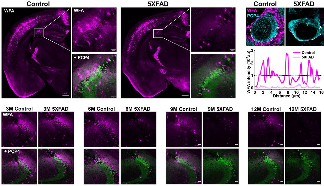 Por que pacientes com Alzheimer esquecem familiares e amigos?