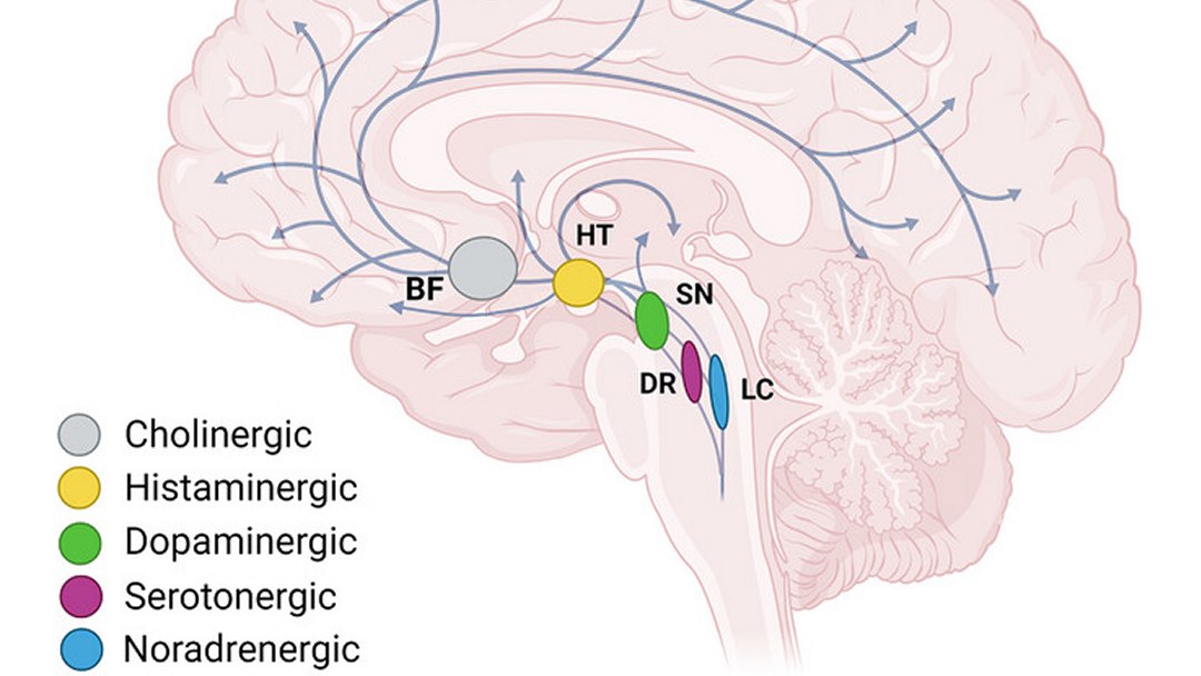 Por que pacientes com Alzheimer esquecem familiares e amigos?