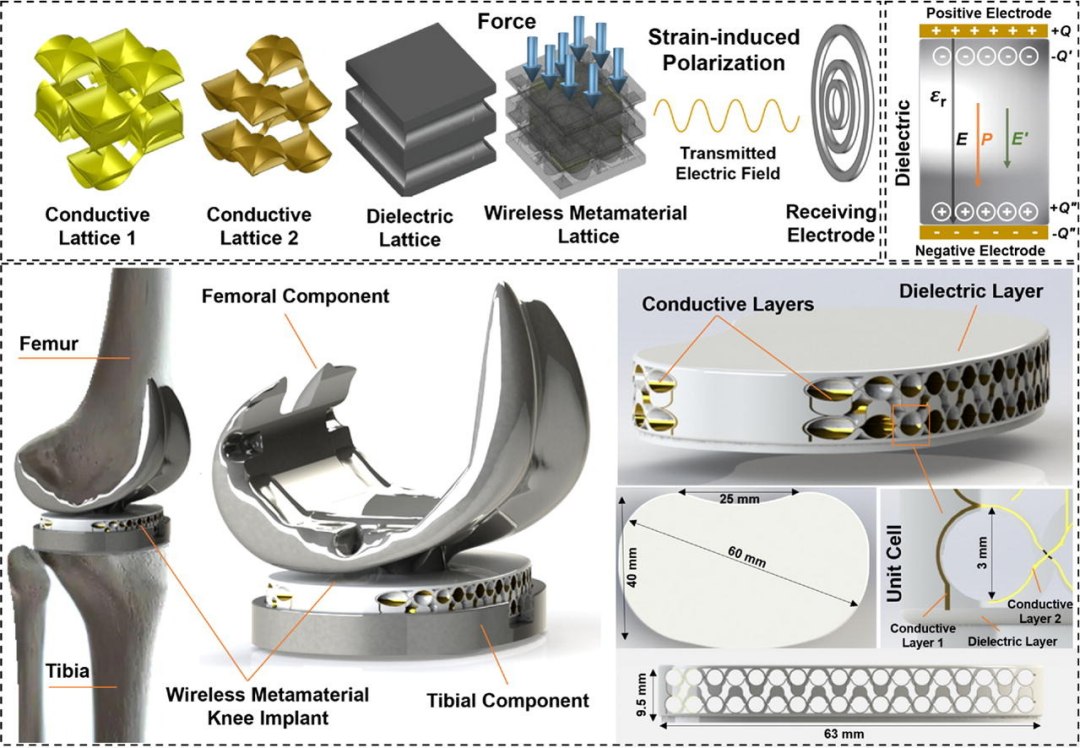 Implante para coluna detecta a cicatrizao e transmite dados sem fios