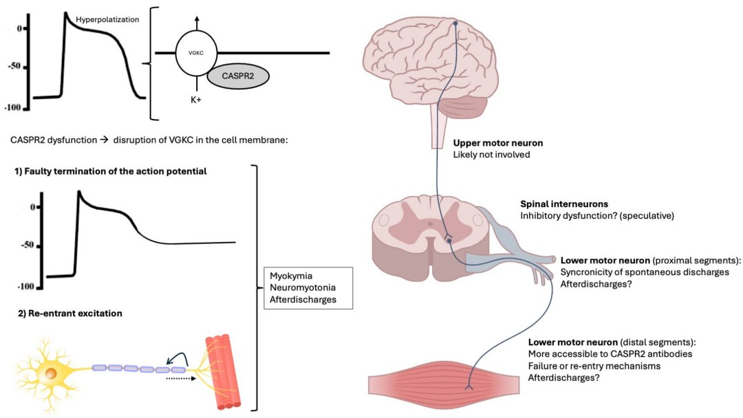 O que acontece quando o sistema imunol�gico ataca o sistema nervoso?