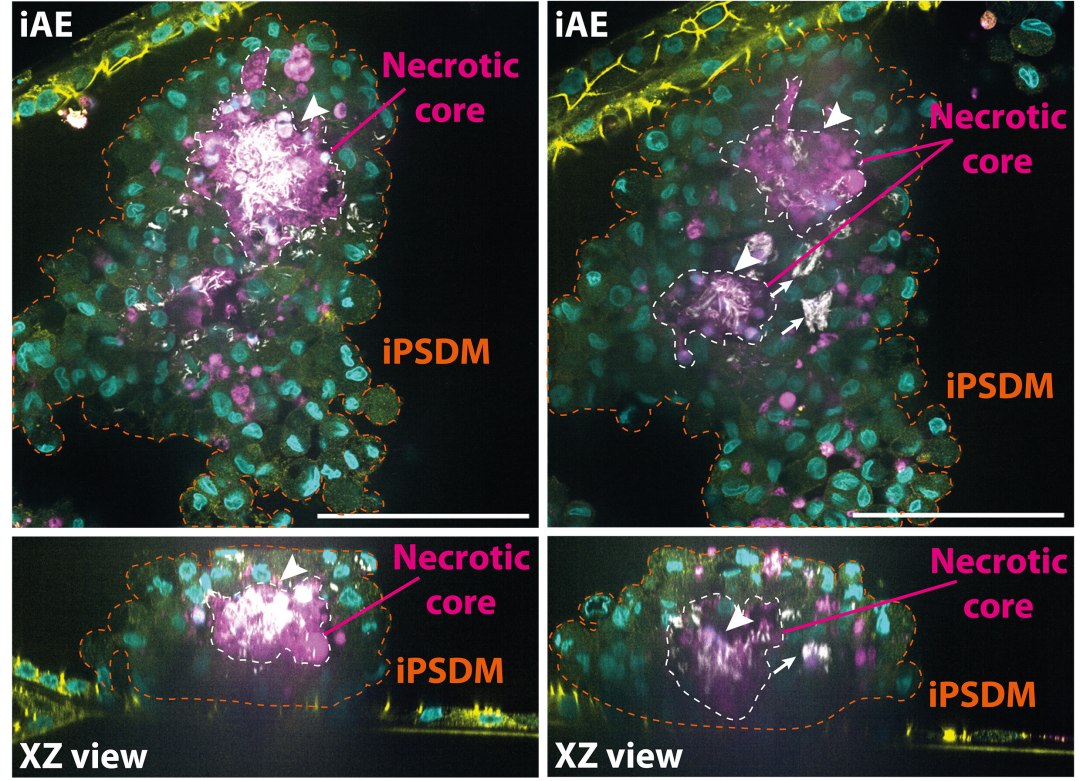 Pulm�o de paciente � simulado dentro de um chip com c�lulas vivas