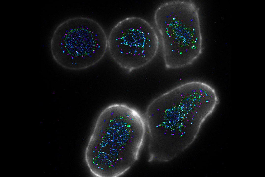 Descoberta forma de fortalecer resposta imunol�gica contra o c�ncer