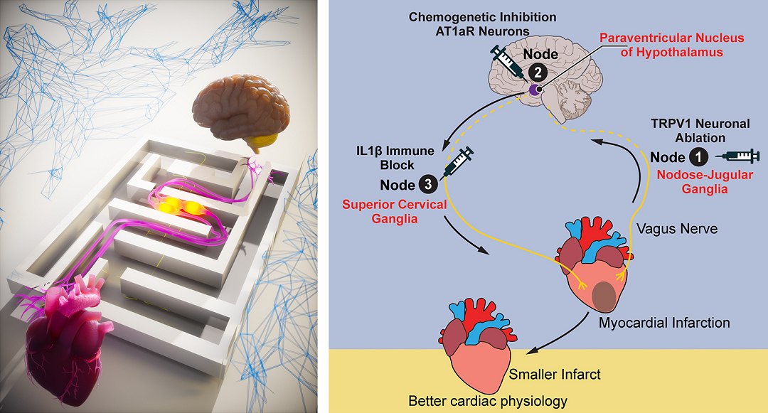Infarto n�o � evento isolado, envolvendo c�rebro, cora��o e sistema imune