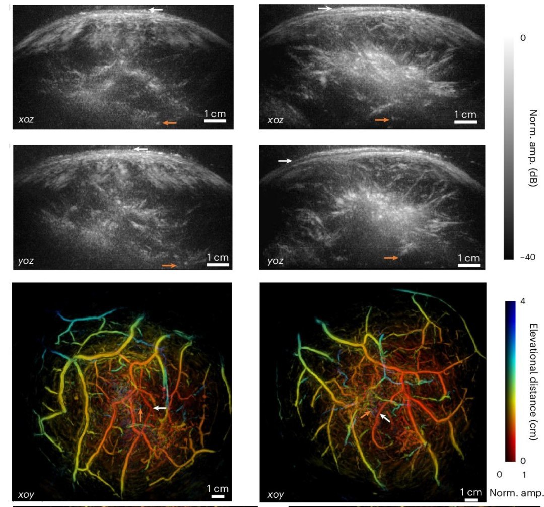 Exames de ultrassom agora em cores e muito mais detalhes