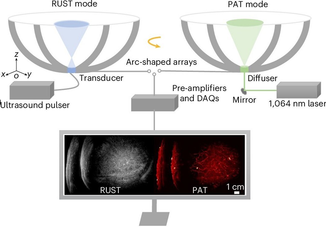 Exames de ultrassom agora em cores e muito mais detalhes