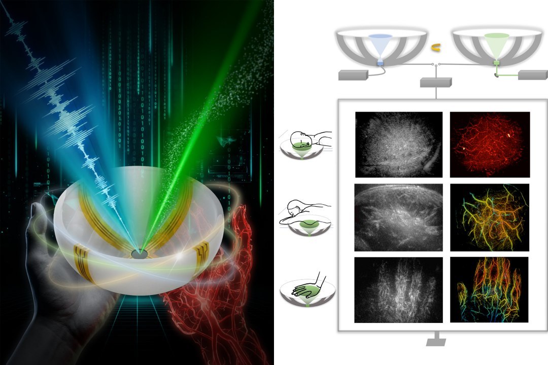 Exames de ultrassom agora em cores e muito mais detalhes