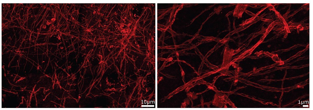 Descoberta estrutura misteriosa de limpeza do c�rebro