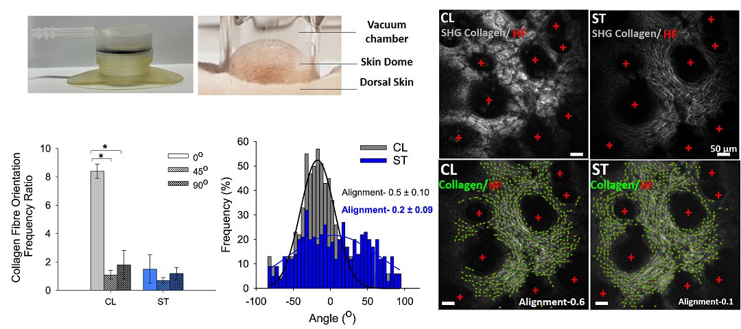 Basta esticar ou massagear a pele para alertar o sistema imunol�gico