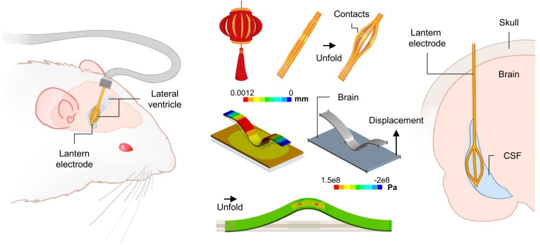 Neurochip l� pensamentos a partir do l�quido que envolve o c�rebro