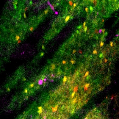 Neurnio mestre pode ser capaz de quebrar hbitos e vcios