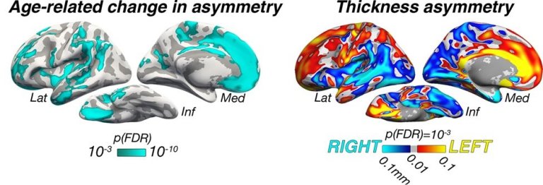 Lados direito e esquerdo do crebro envelhecem de modo diferente