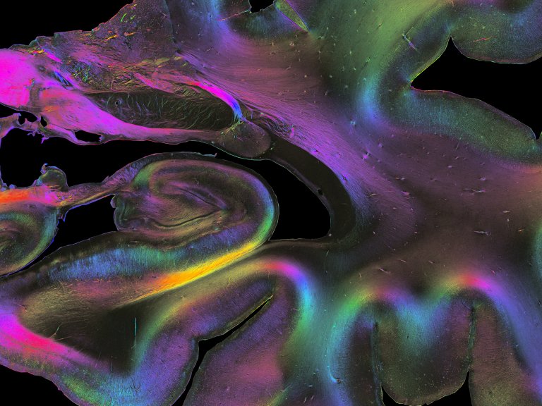 Uma nova viso sobre o crebro: Est tudo nas conexes