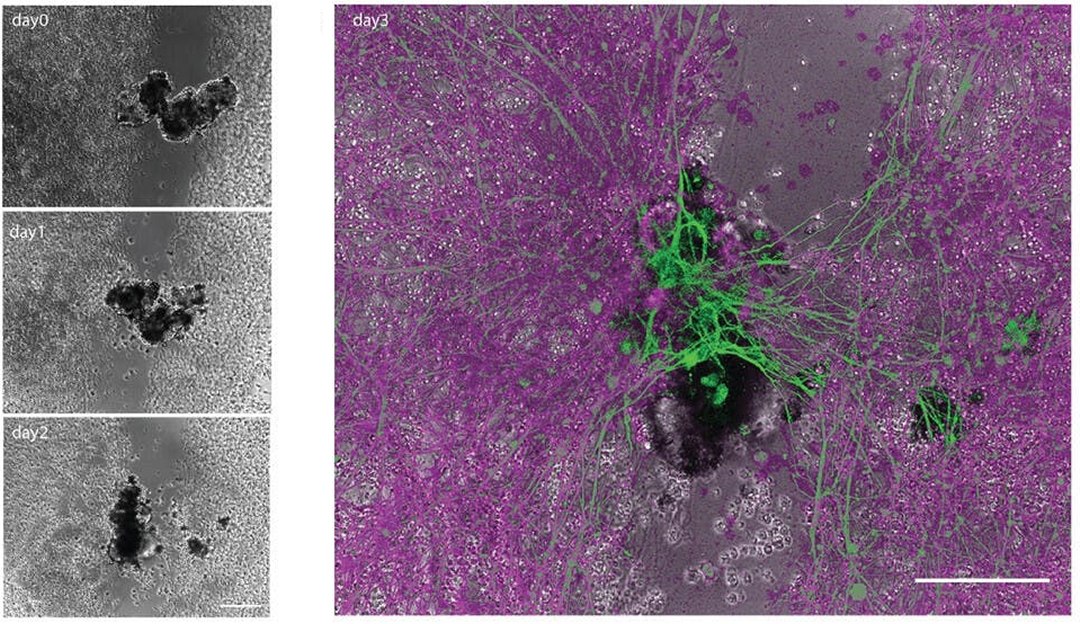 Intelig�ncia Artificial pode mudar nossa vis�o da morte?