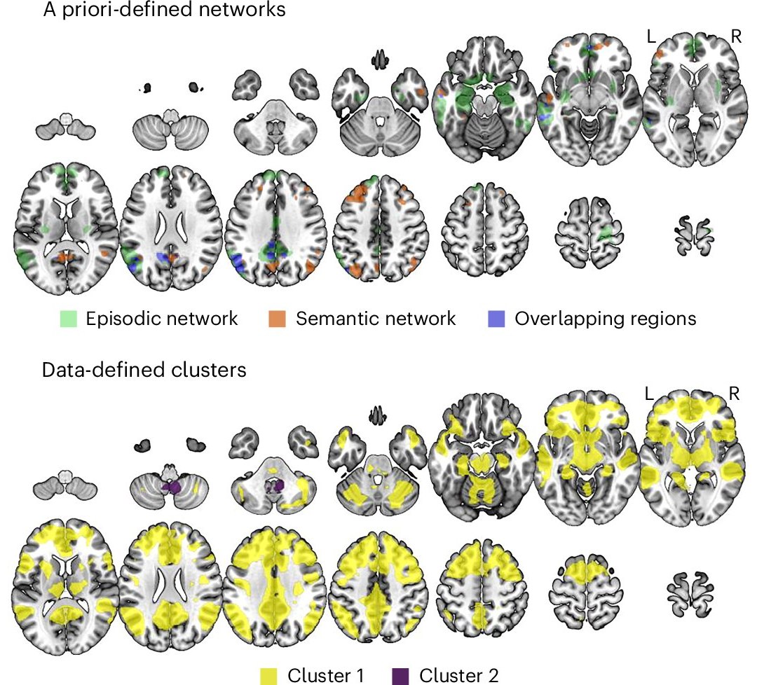 Descoberta for�a cientistas a repensarem funcionamento da mem�ria