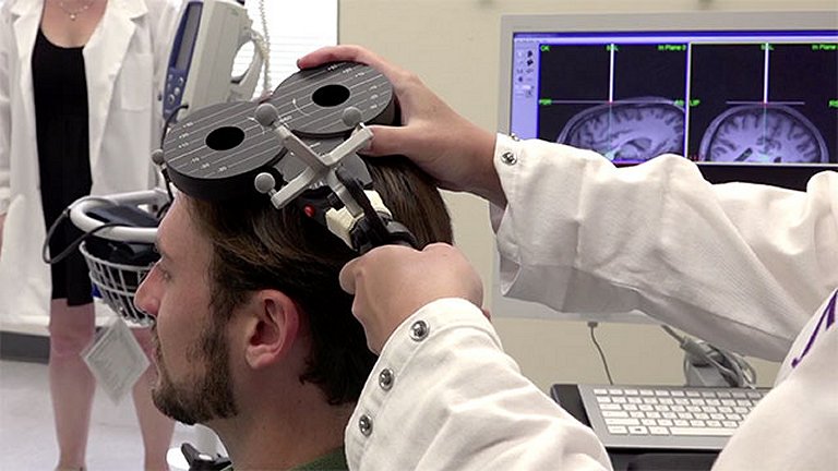 Estimulação magnética do cérebro melhora memória rapidamente