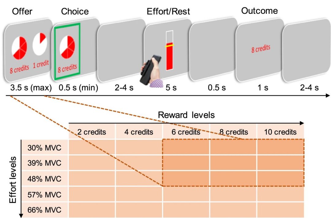 A atividade cerebral muda ao longo do dia