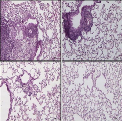 Nova vacina contra tuberculose apresenta resultados promissores