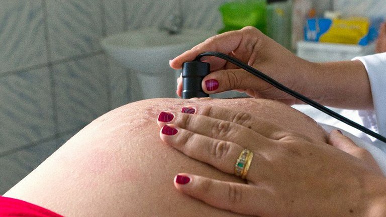 ANS lança campanha contra cesarianas desnecessárias