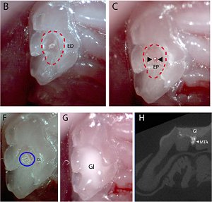 Brasileiro cria substncia que regenera dentes