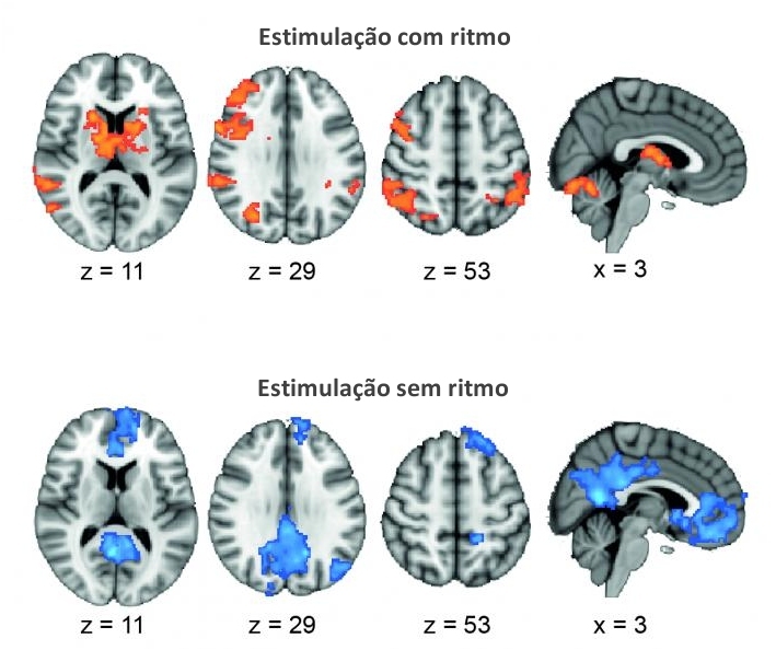 Estimulação elétrica melhora memória sincronizando ondas cerebrais