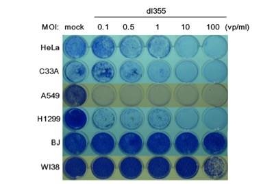 Cientistas projetam um vrus para atacar o cncer