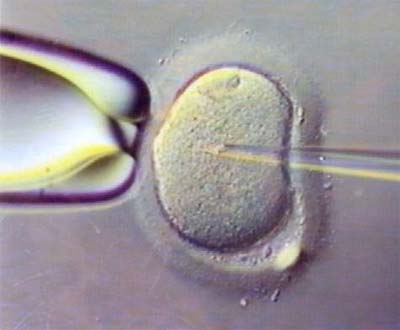 Nova técnica de fertilização <i>in vitro</i> não apresenta ganhos