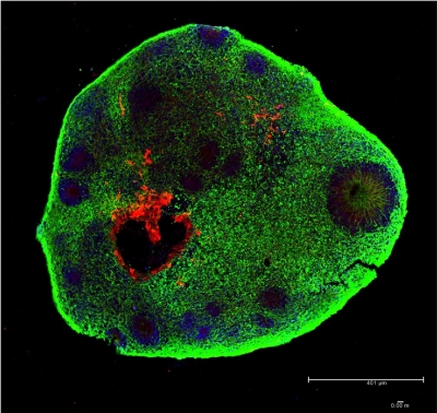 Minicérebros em laboratório desenvolvem células da retina