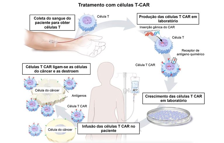 Pesquisadores brasileiros reduzem custo de tratamento inovador contra o câncer