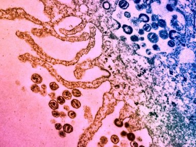 Molcula antibitica recupera defesa contra clulas infectadas pelo HIV
