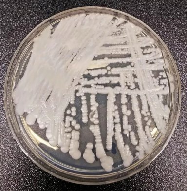 Descoberto novo alvo para eliminar bactérias resistentes a antibióticos