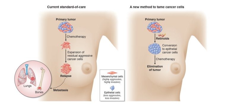 Descoberto tratamento para tipo mais agressivo do cncer de mama