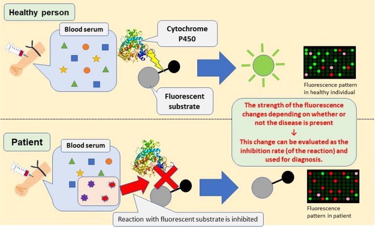 Biomarcador permite pela primeira vez diagnosticar doena de Parkinson