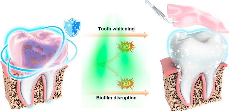 Novo tratamento clareia os dentes em danificar o esmalte