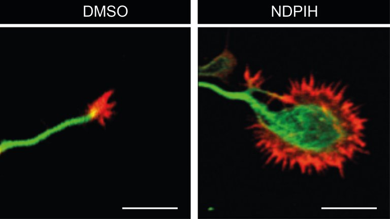 Cogumelo melhora a memria estimulando o crescimento dos neurnios